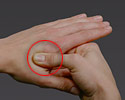 Akupressur-Punkt an der Hand gegen Kopfschmerzen