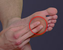 Akupressur-Punkt an der Fußsohle gegen Müdigkeit