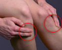Akupressur-Punkt bei der Kniescheibe gegen Bauchschmerzen